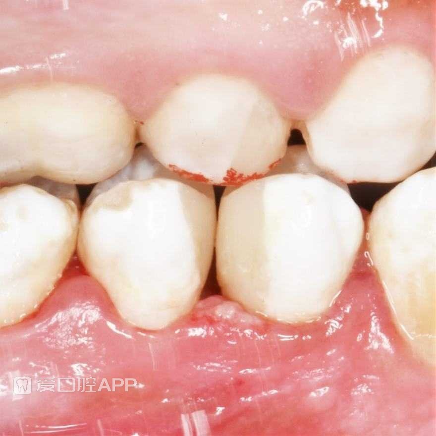 18.jpg