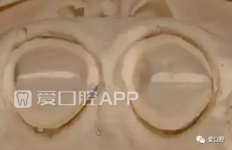 195336wff21blohfo7gl6c.jpeg
