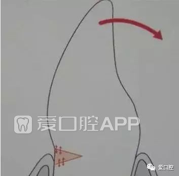 195653yzb2rf5fdfjkubdk.jpeg