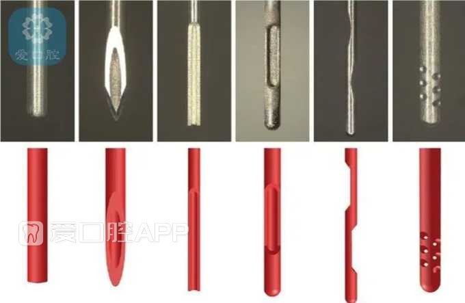 不同的注射器针头形态，A-C 为末端开敞；D-F 为侧方开口（来自C.Boutsioukis. International Endodontic Jo ...