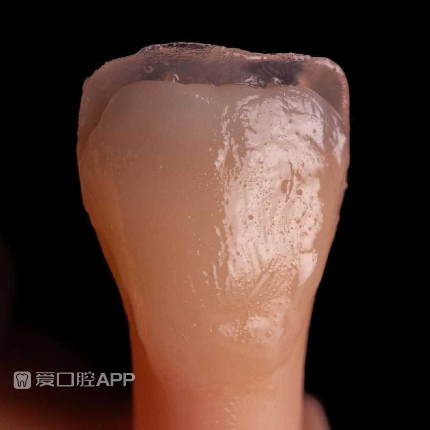 sofeska_dent_412896624.jpg
