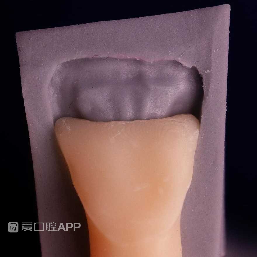sofeska_dent_412896648.jpg