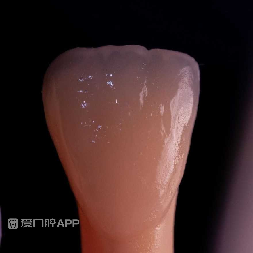 sofeska_dent_412896589.jpg