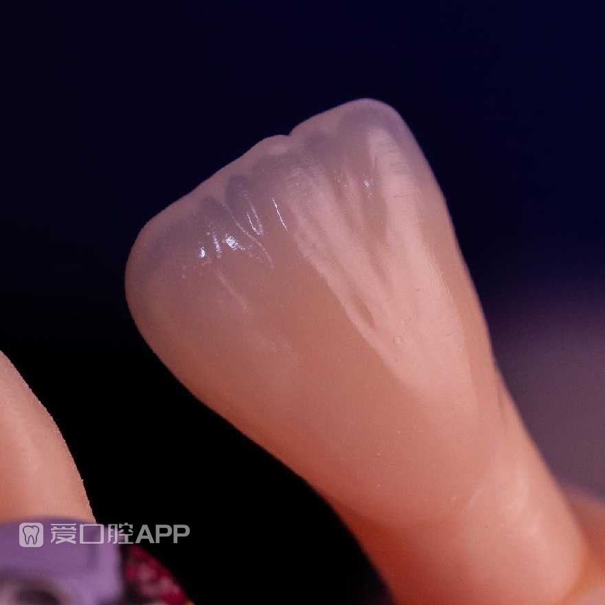 sofeska_dent_412896578.jpg