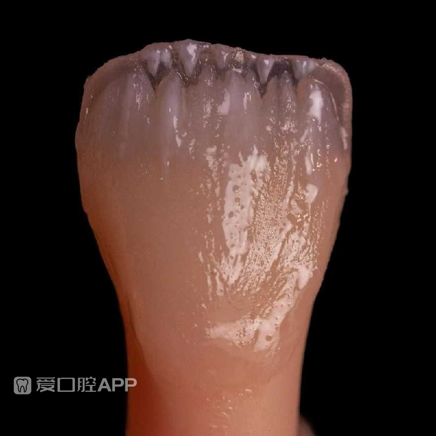 sofeska_dent_412896601.jpg