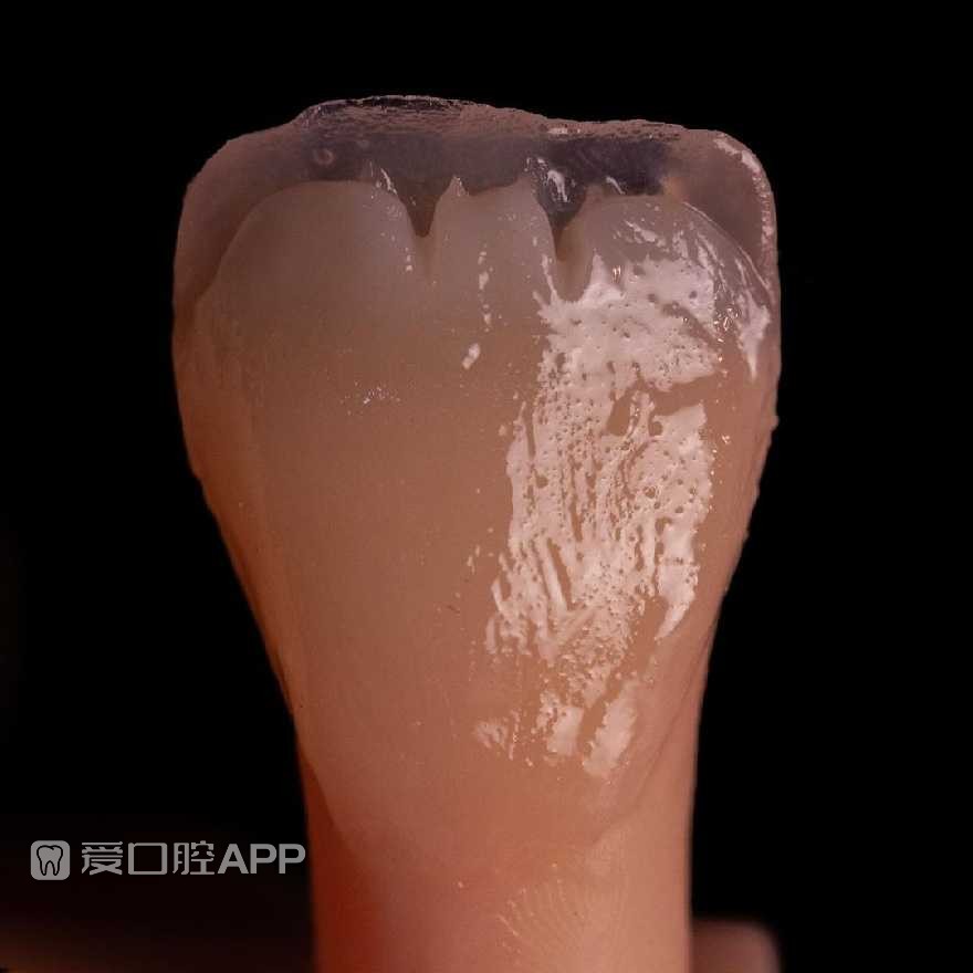 sofeska_dent_412896613.jpg