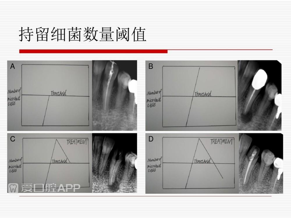 (完整版)口腔根管治疗标准化操作流程_9.jpg