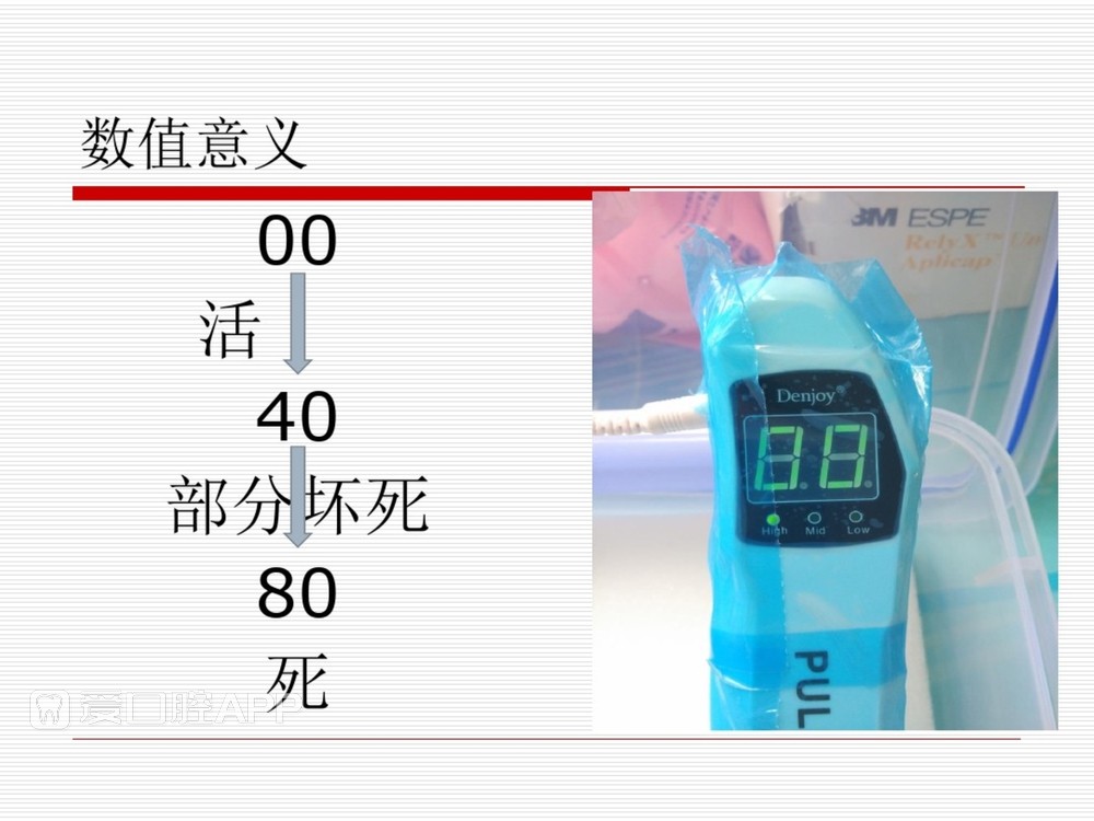 (完整版)口腔根管治疗标准化操作流程_19.jpg