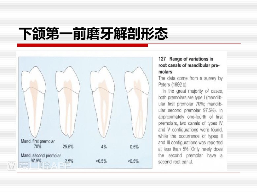 (完整版)口腔根管治疗标准化操作流程_30.jpg