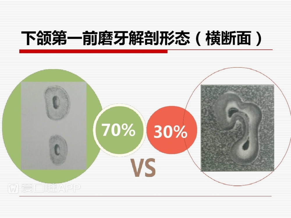 (完整版)口腔根管治疗标准化操作流程_31.jpg