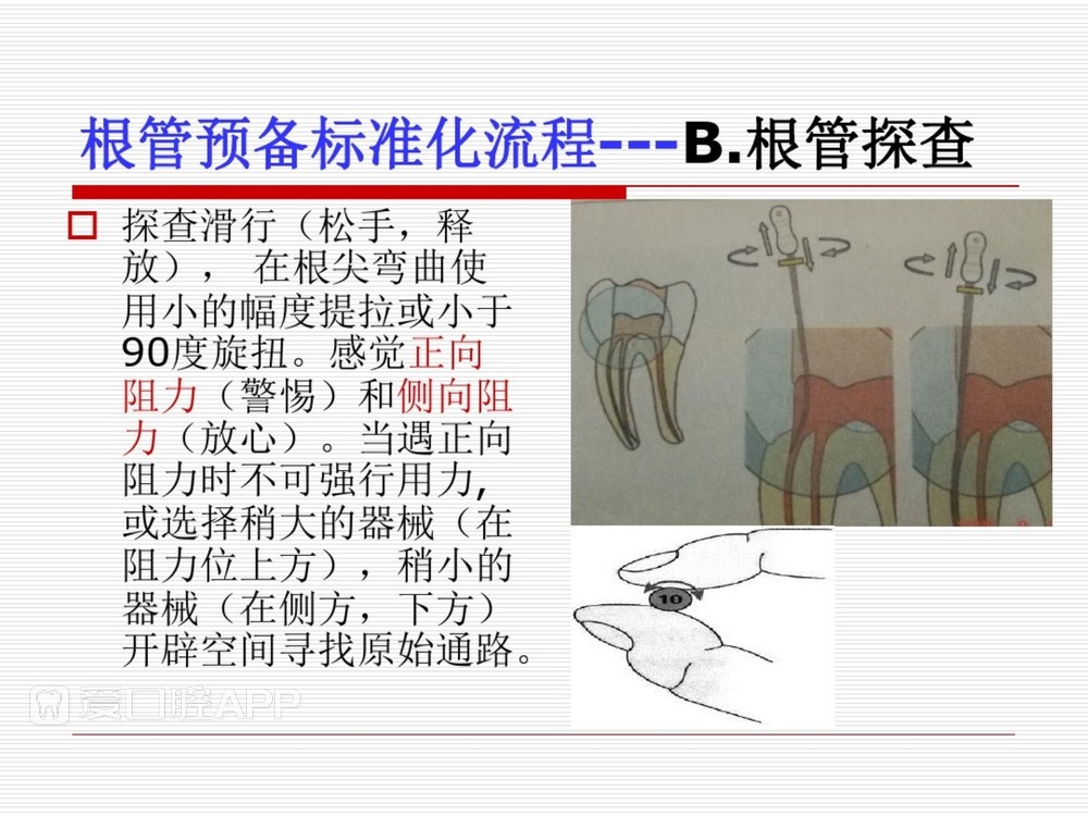(完整版)口腔根管治疗标准化操作流程_37.jpg
