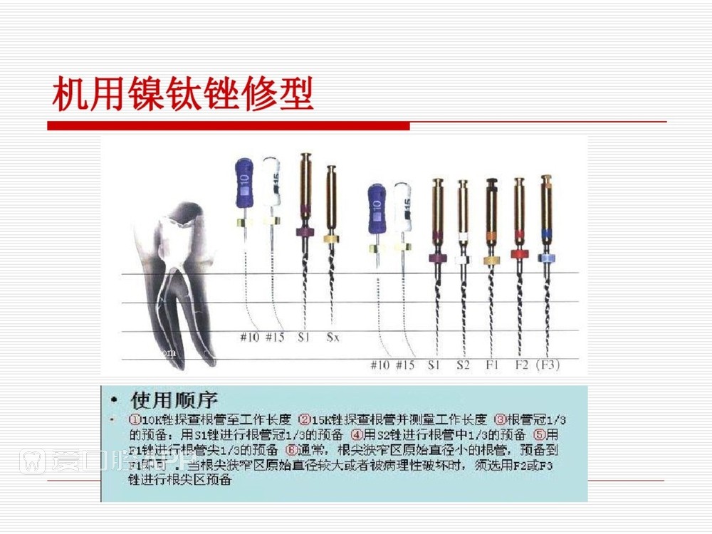 (完整版)口腔根管治疗标准化操作流程_42.jpg