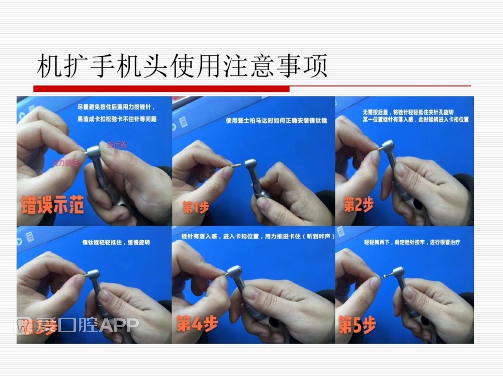 (完整版)口腔根管治疗标准化操作流程_46.jpg