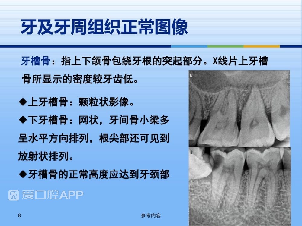 牙体牙周正常解剖及常见病X线表现(内容丰富)_8.jpg