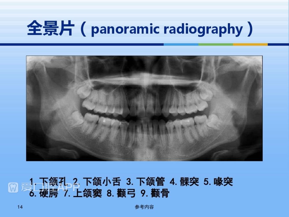 牙体牙周正常解剖及常见病X线表现(内容丰富)_14.jpg