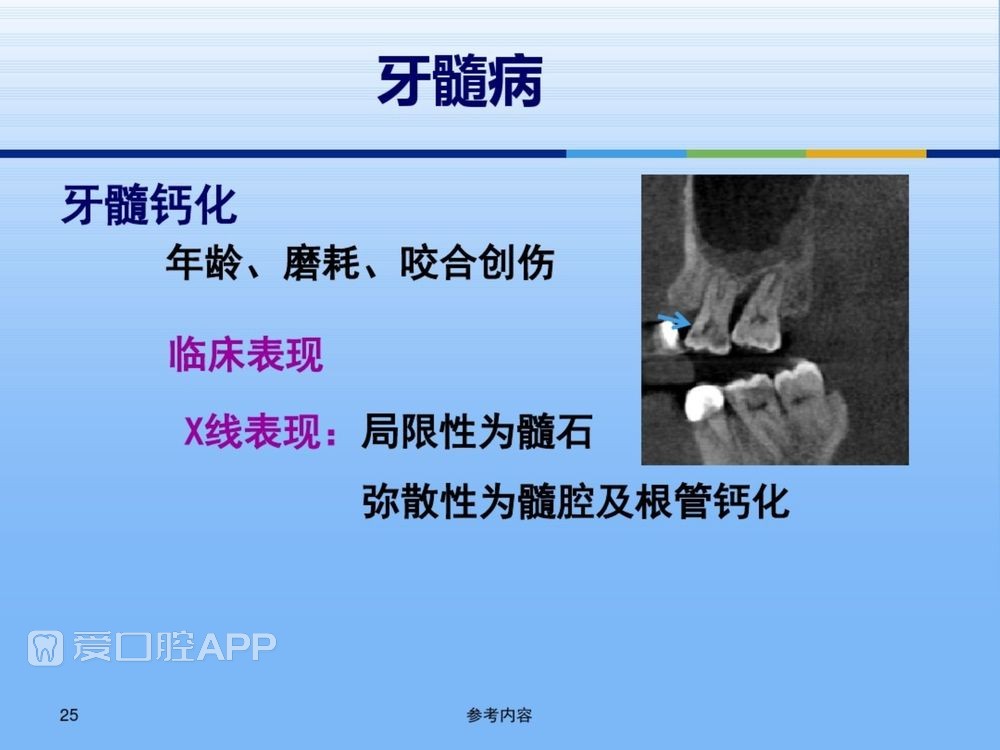 牙体牙周正常解剖及常见病X线表现(内容丰富)_25.jpg