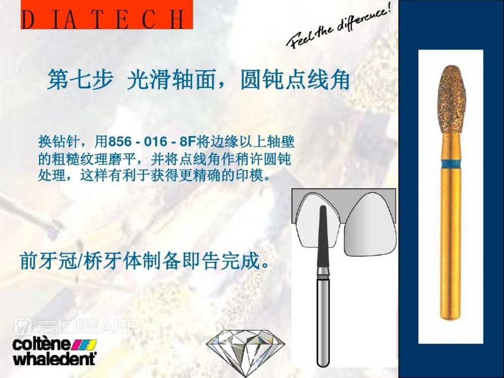 牙体预备和精确取模型 (11).jpg