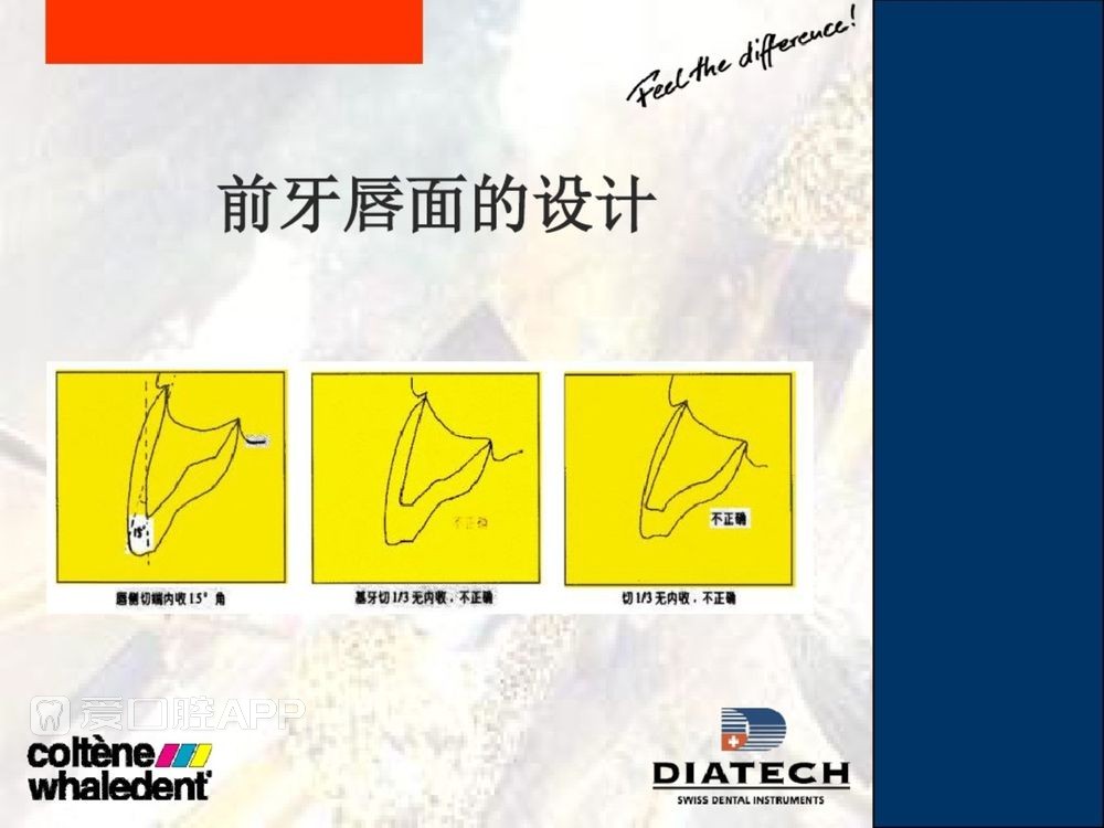 牙体预备和精确取模型 (12).jpg