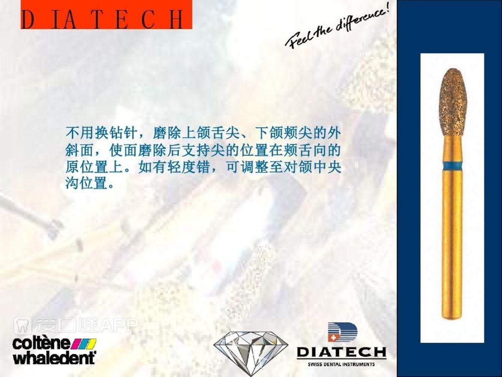 牙体预备和精确取模型 (15).jpg