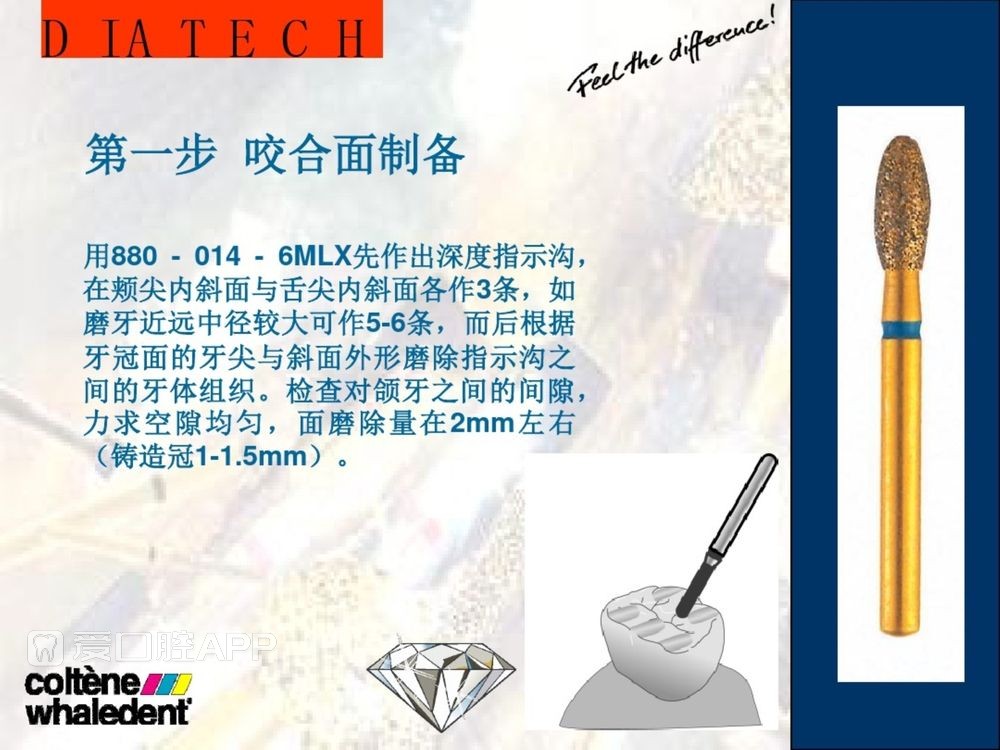 牙体预备和精确取模型 (14).jpg