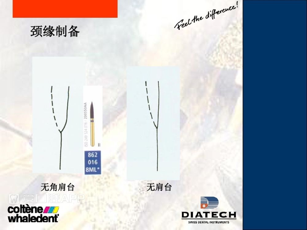 牙体预备和精确取模型 (22).jpg