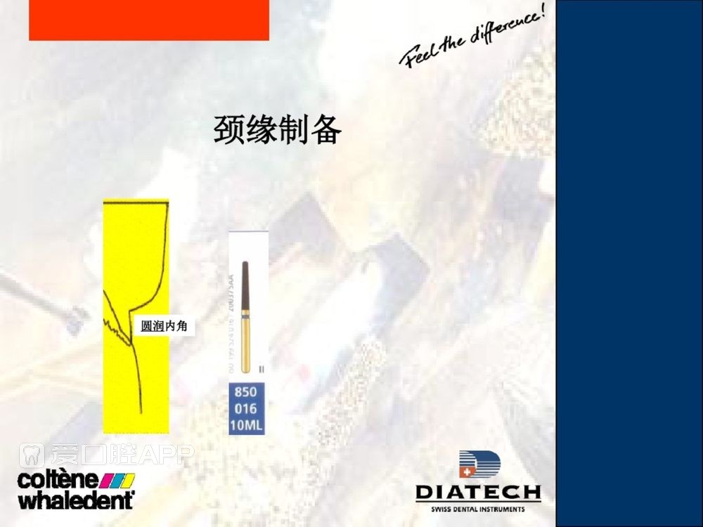 牙体预备和精确取模型 (23).jpg