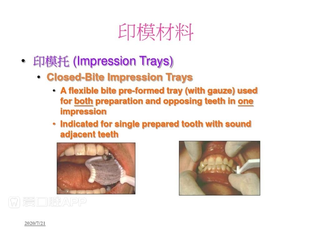 牙体预备和精确取模型 (57).jpg
