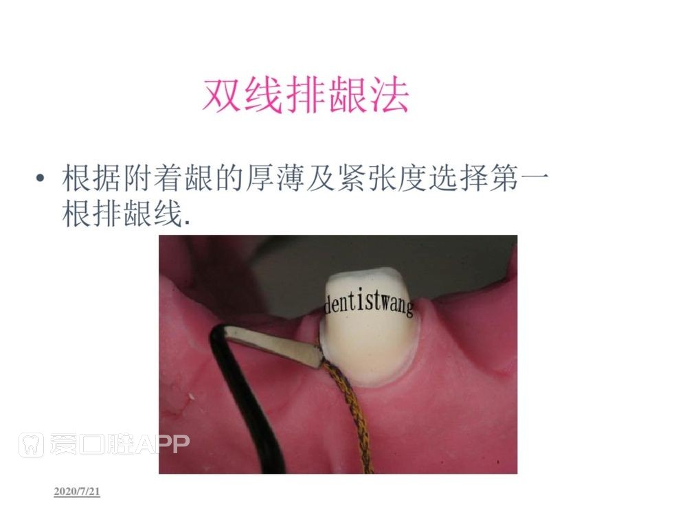 牙体预备和精确取模型 (80).jpg