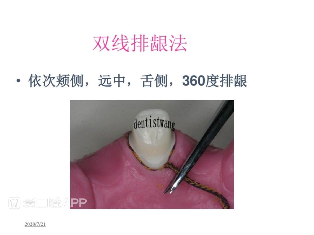 牙体预备和精确取模型 (82).jpg