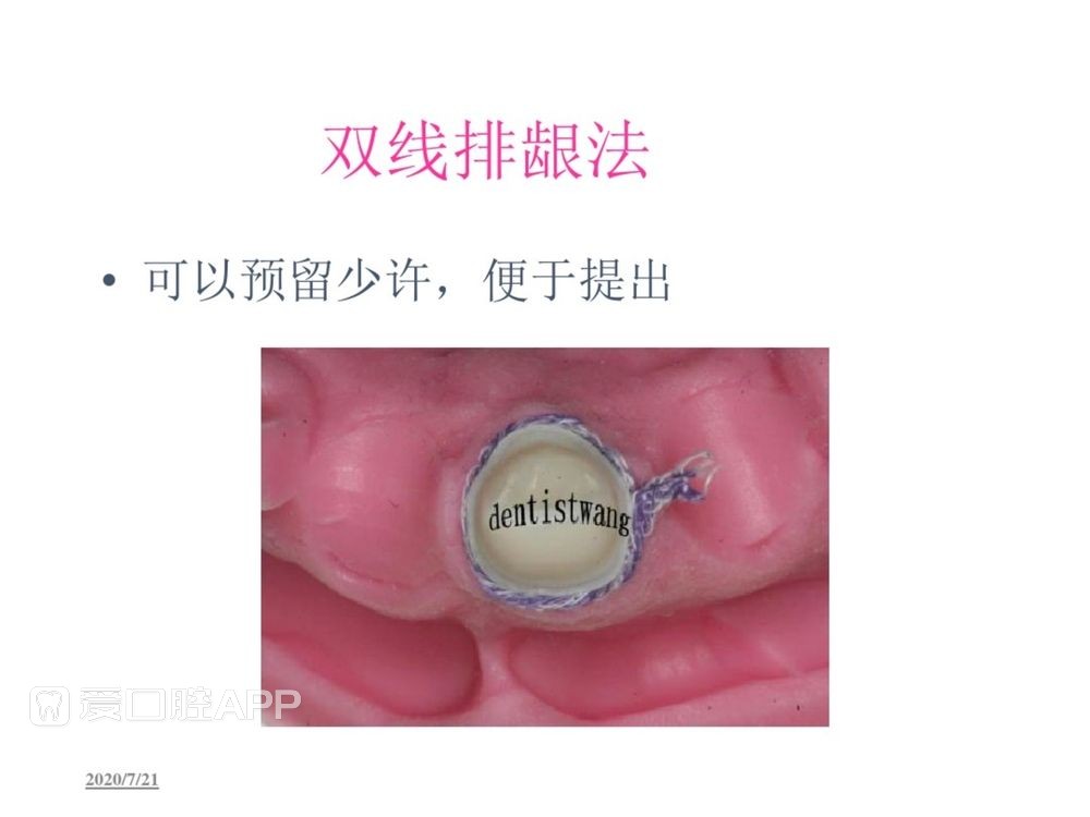 牙体预备和精确取模型 (86).jpg