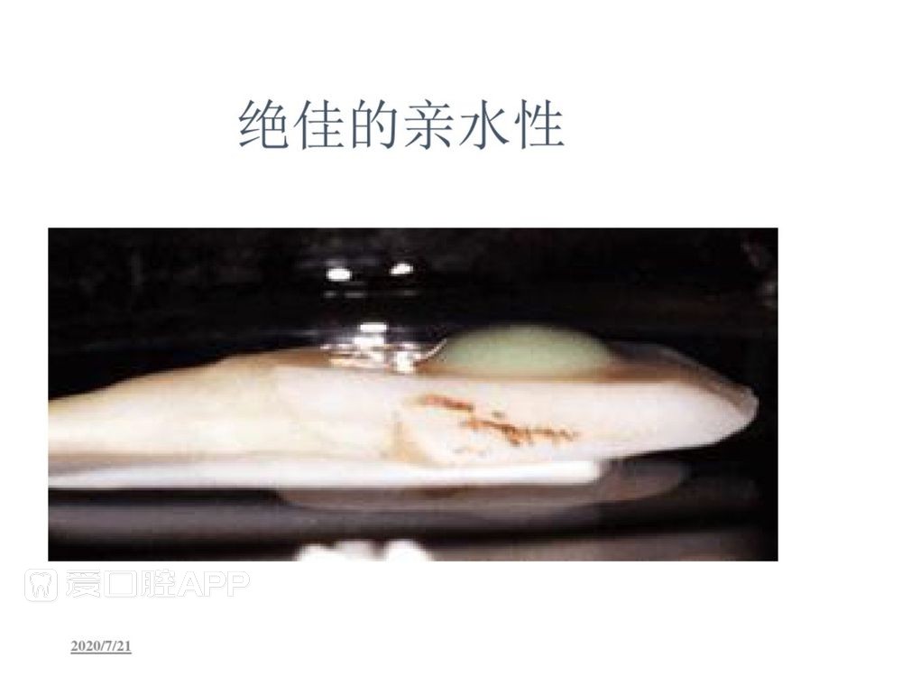 牙体预备和精确取模型 (98).jpg