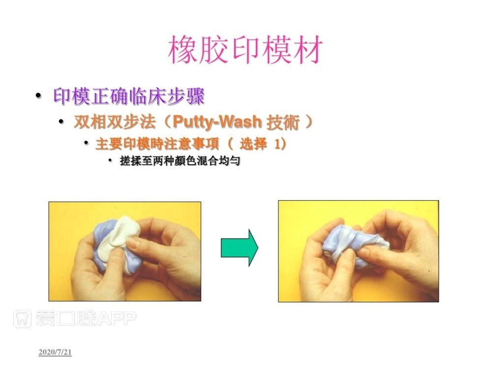 牙体预备和精确取模型 (104).jpg