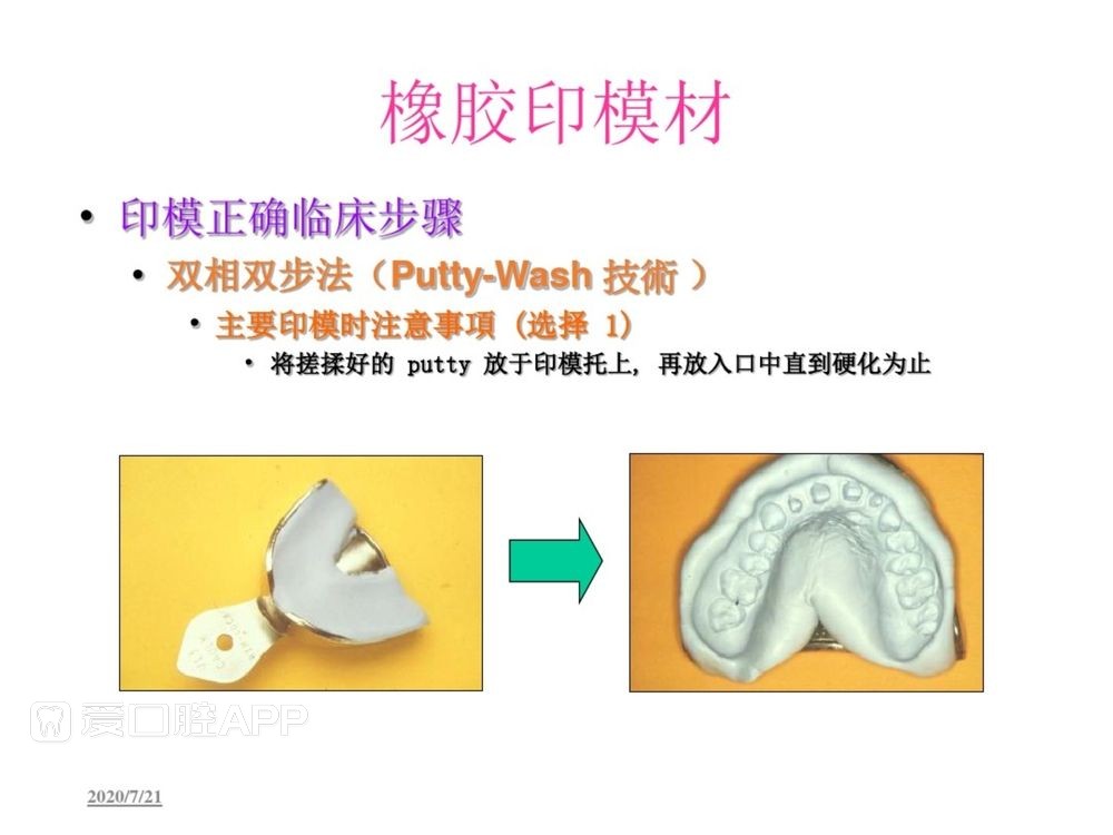 牙体预备和精确取模型 (105).jpg