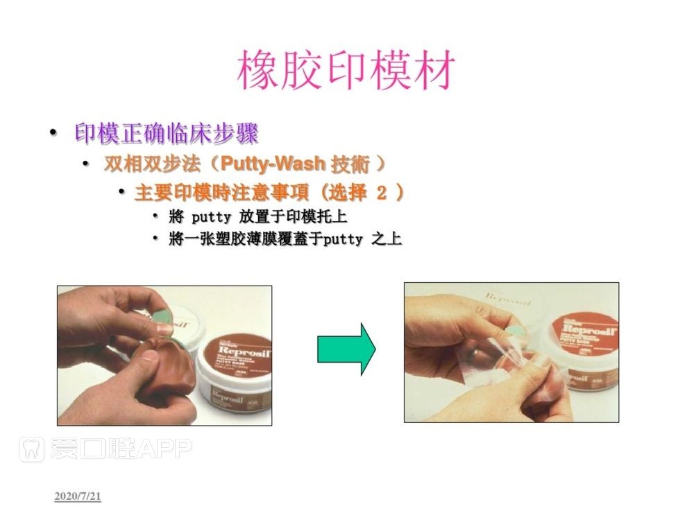 牙体预备和精确取模型 (108).jpg