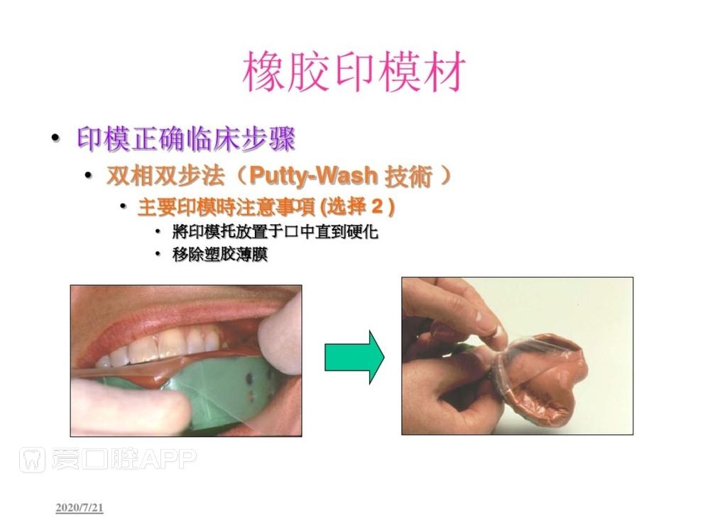 牙体预备和精确取模型 (109).jpg