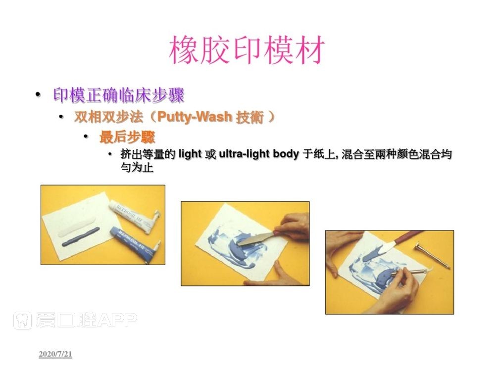 牙体预备和精确取模型 (110).jpg