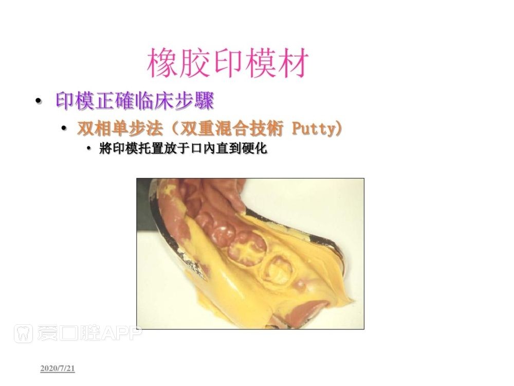 牙体预备和精确取模型 (119).jpg