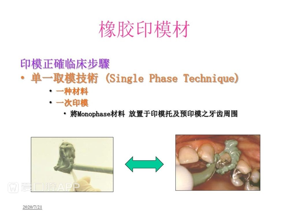 牙体预备和精确取模型 (124).jpg