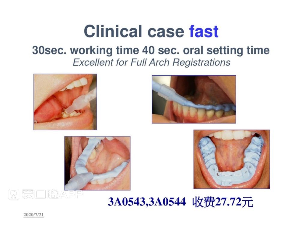 牙体预备和精确取模型 (129).jpg